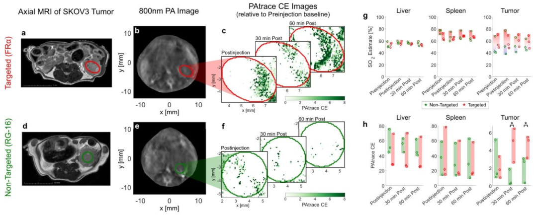 Nature Sub-Journal: Photoacoustic Imaging Technology for Precise Visualization of Tumor Microenvironments