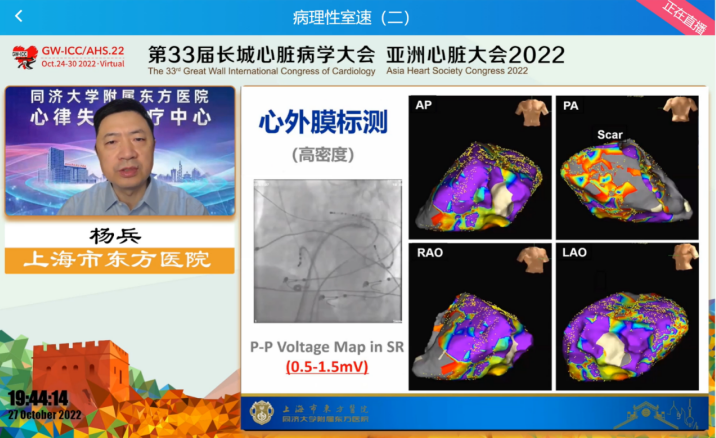 GW-ICC Report | Ventricular Arrhythmia Forum: Overcoming Challenges in Electrophysiological Technology