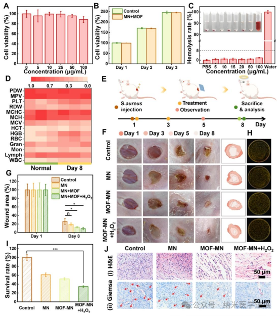 Professor Dong Haifeng from Beijing University of Science and Technology in ACS NANO: Bimetallic Metal-Organic Framework Microneedle Array Promotes Wound Healing through Targeted Reactive Oxygen Species Generation and Disruption of Electron Transfer