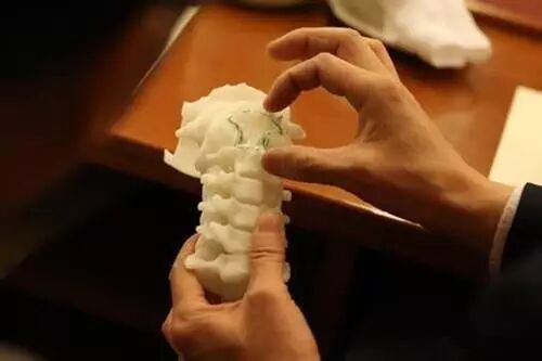 Amazing High-Tech! 3D Printed Human Bones Are Actually Used in Surgery...