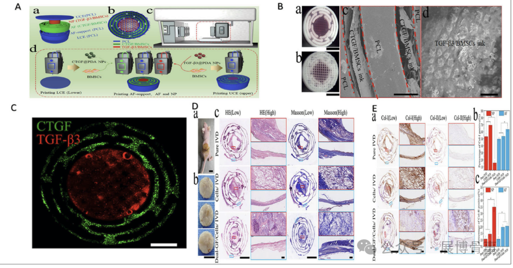 Innovative Solutions for Intervertebral Disc Degeneration: Breakthroughs in 3D Bioprinting by a South Korean Team