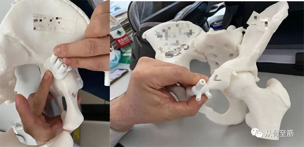 Applications of 3D Printing Technology in Orthopedics