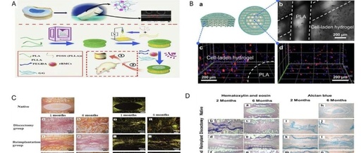 Innovative Solutions for Intervertebral Disc Degeneration: Breakthroughs in 3D Bioprinting by a South Korean Team