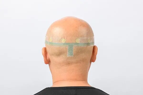 Industry Applications of Stretchable Circuit Boards