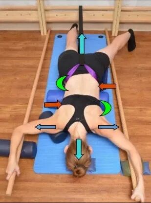 Introduction of Barcelona BSPTS: A New International Solution for Scoliosis Correction