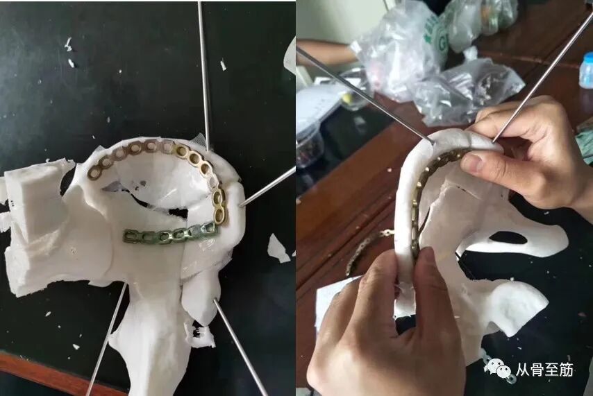 Applications of 3D Printing Technology in Orthopedics