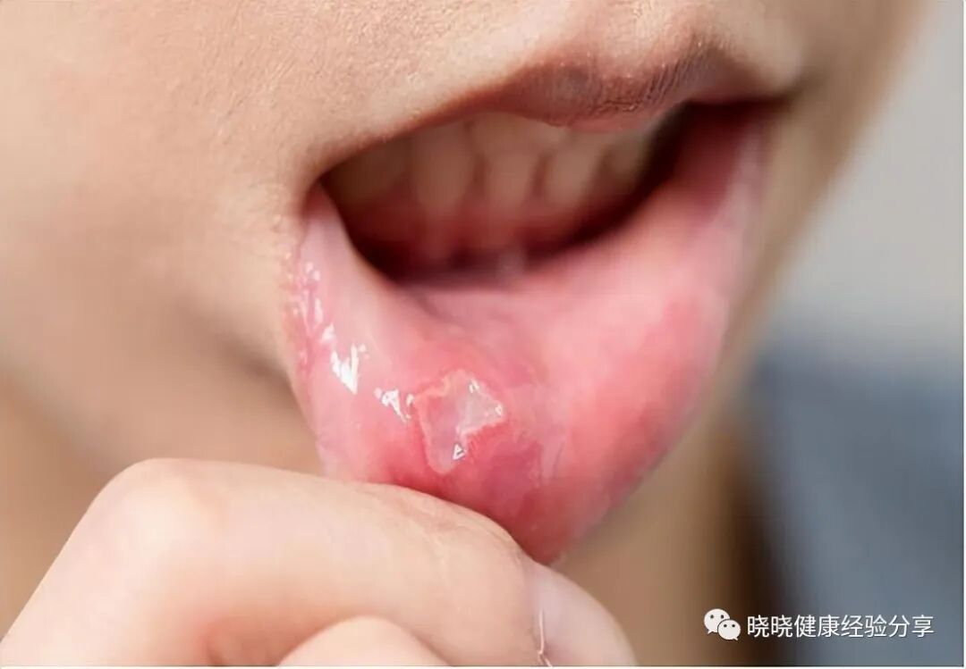 What Happens to People Who Take Vitamin C Daily? Can Vitamin C Be Taken Every Day?