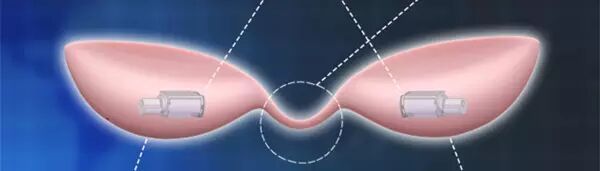 Smart Bras: The Innovative Use of Circuit Boards!