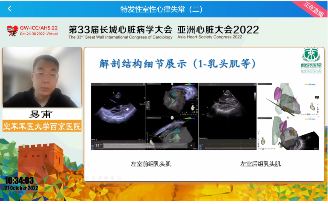 GW-ICC Report | Ventricular Arrhythmia Forum: Overcoming Challenges in Electrophysiological Technology