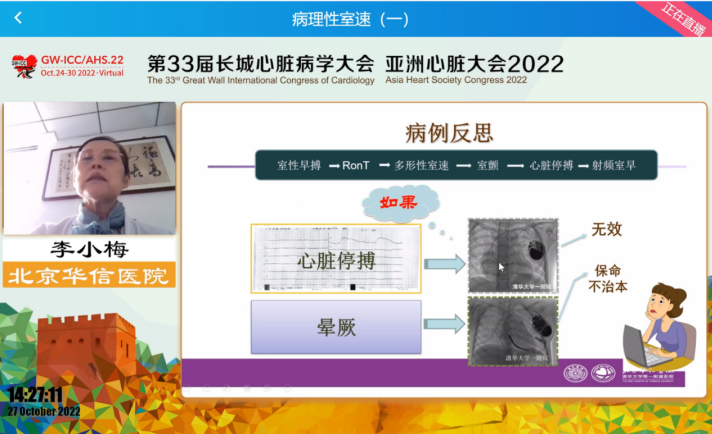 GW-ICC Report | Ventricular Arrhythmia Forum: Overcoming Challenges in Electrophysiological Technology