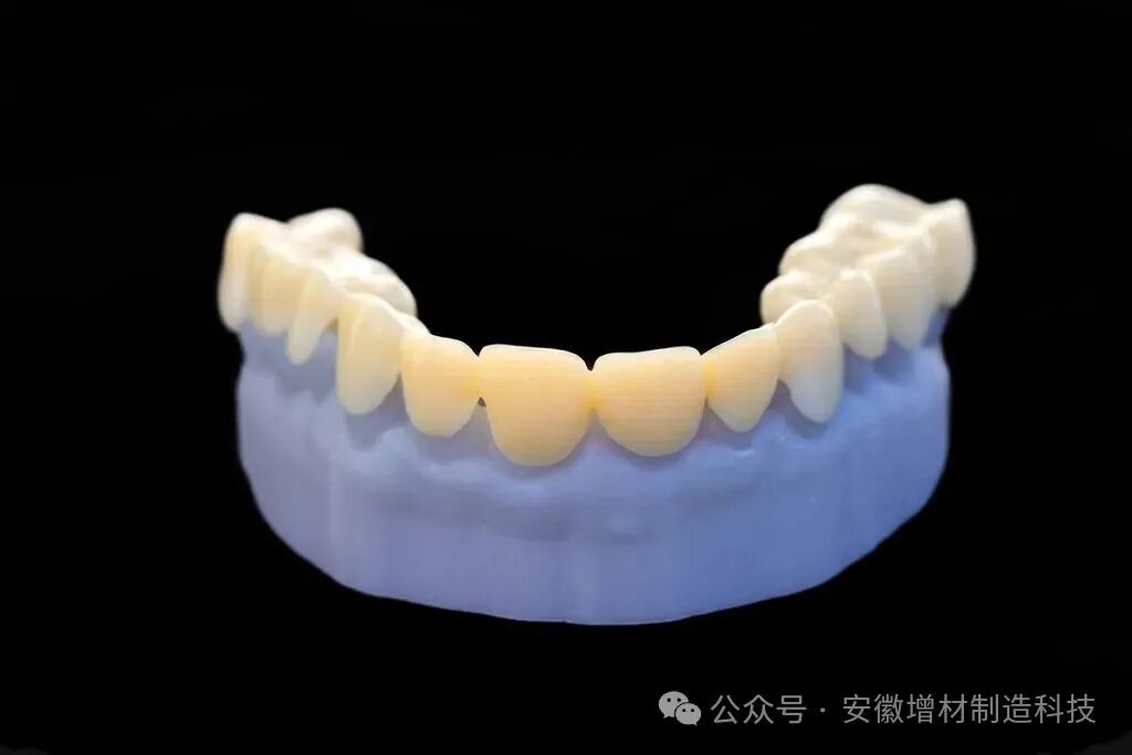 3D Printing Disrupts the Dental Industry: Global Clinics Accelerate Deployment, Market Size Approaching $10 Billion by 2033