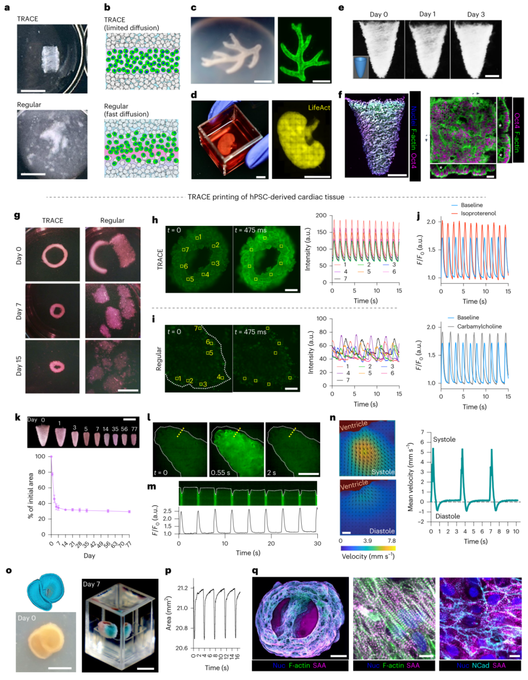3D Bioprinting | Gelation in Less Than 1 Second, Featured in Nature Materials!