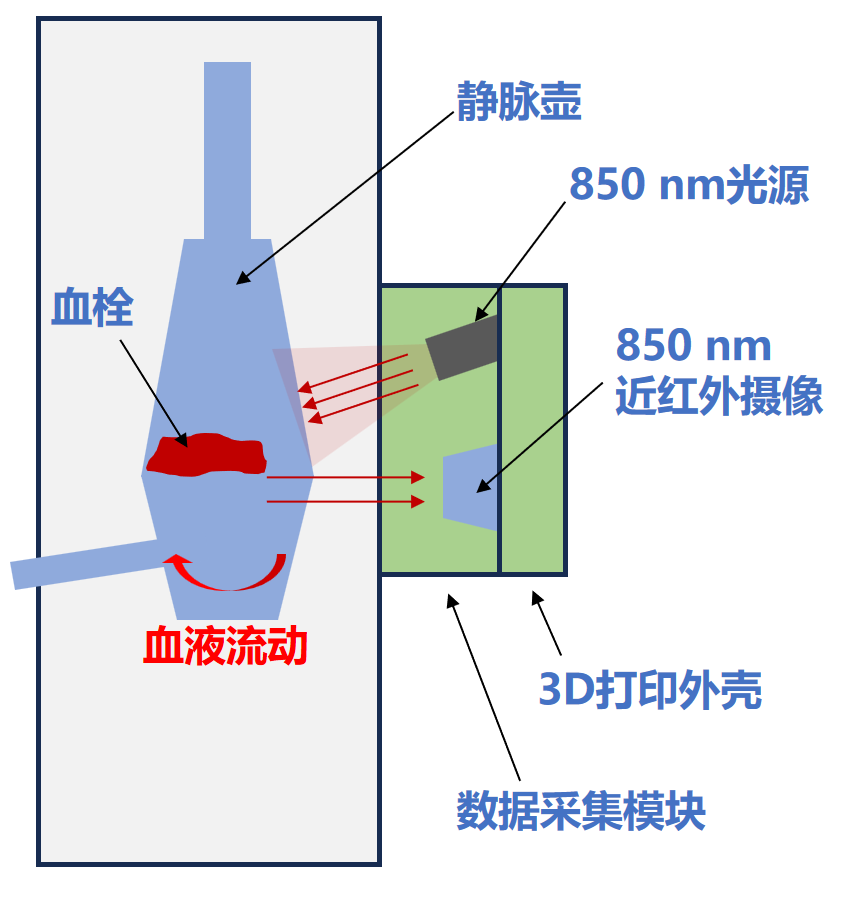 Professor Zhang Ling: Advances and Breakthroughs in Severe Blood Purification Technology