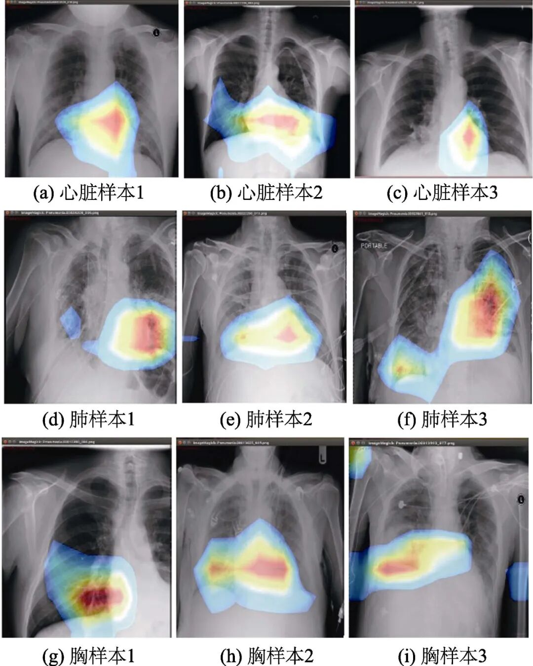 Design and Implementation of a Computer-Aided Diagnosis System Based on Deep Learning in Embedded Systems