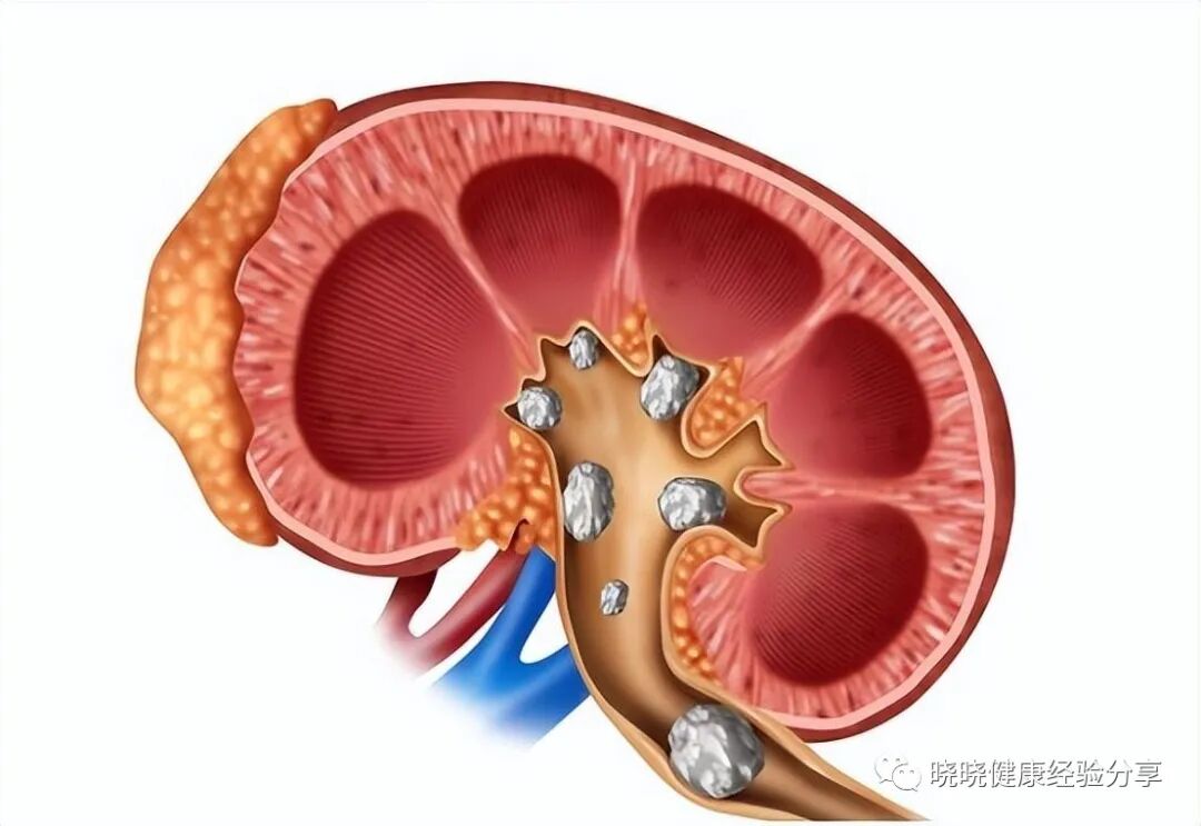 What Happens to People Who Take Vitamin C Daily? Can Vitamin C Be Taken Every Day?
