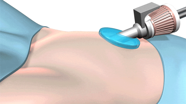 Analysis of the Smart Medical Robot Industry Chain