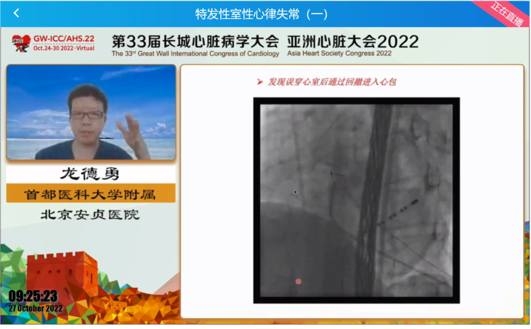 GW-ICC Report | Ventricular Arrhythmia Forum: Overcoming Challenges in Electrophysiological Technology