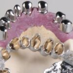 FIDENTIS Redefines Dentures Through Multi-Material 3D Printing