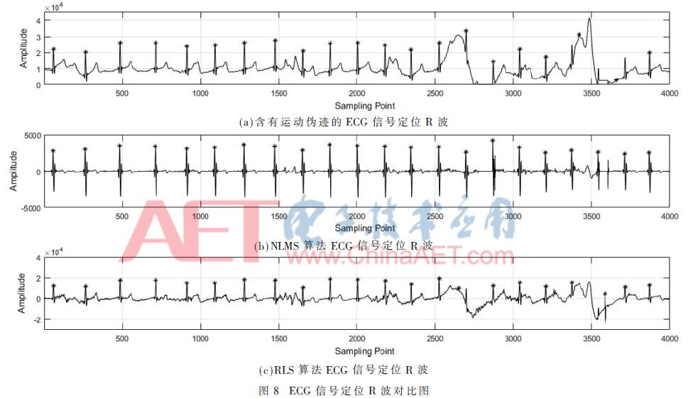 Wearable ECG Signal Detection System Based on Adaptive Filtering