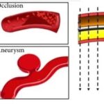 Beijing Institute of Technology Team Magnetizes Microrobots to Simulate Parkour in Blood Vessels and Manipulate Microscopic Objects