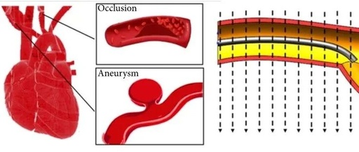 Beijing Institute of Technology Team Magnetizes Microrobots to Simulate Parkour in Blood Vessels and Manipulate Microscopic Objects