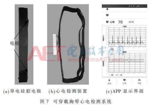 Wearable ECG Signal Detection System Based on Adaptive Filtering