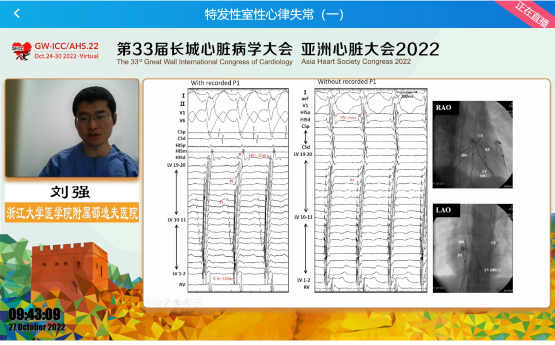 GW-ICC Report | Ventricular Arrhythmia Forum: Overcoming Challenges in Electrophysiological Technology