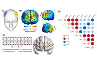 Professor Duan Haijun's Team Reveals the Neural Mechanism of tDCS Intervention in Improving Stress-Induced Creativity Impairment in Cerebral Cortex