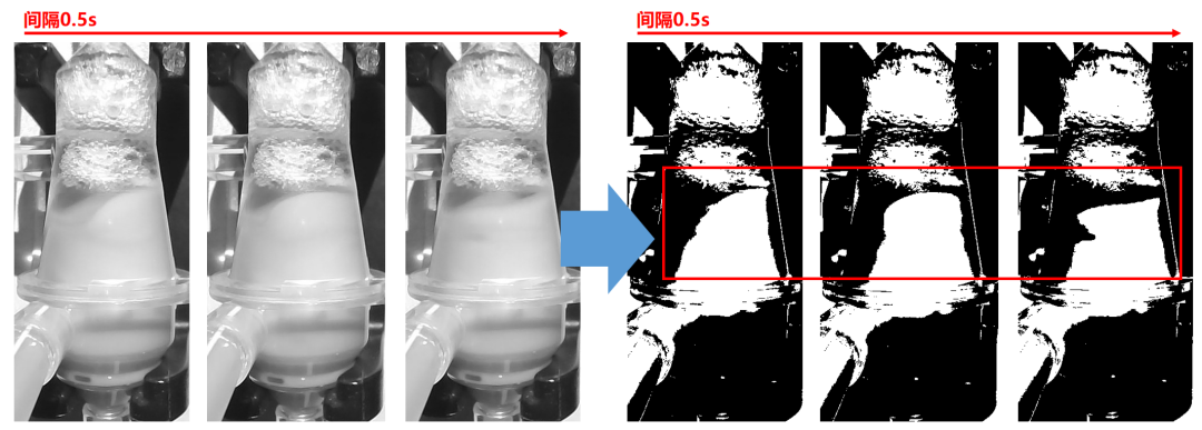 Professor Zhang Ling: Advances and Breakthroughs in Severe Blood Purification Technology