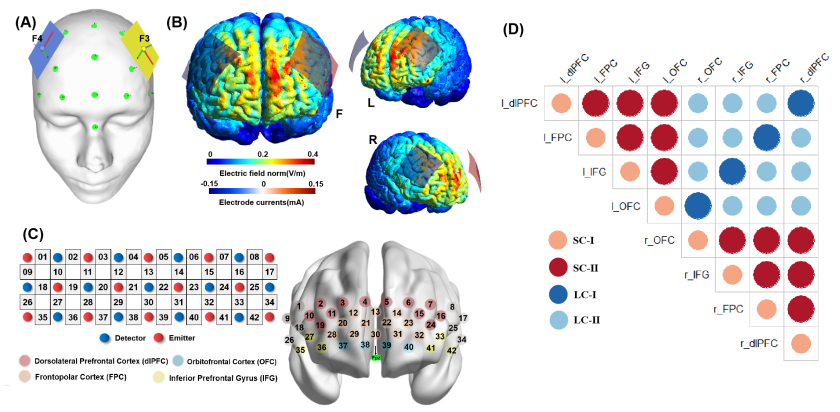 Professor Duan Haijun's Team Reveals the Neural Mechanism of tDCS Intervention in Improving Stress-Induced Creativity Impairment in Cerebral Cortex