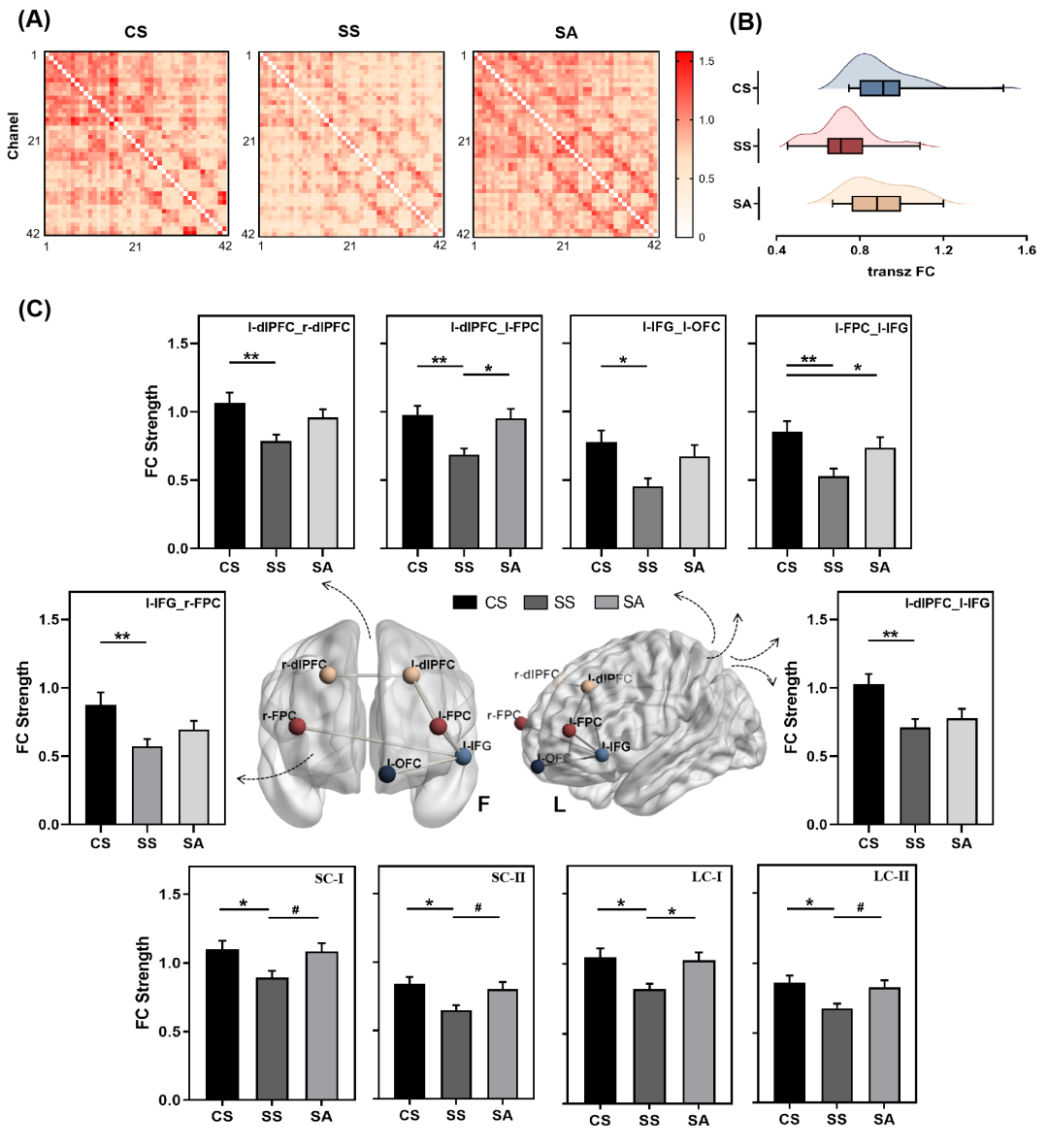 Professor Duan Haijun's Team Reveals the Neural Mechanism of tDCS Intervention in Improving Stress-Induced Creativity Impairment in Cerebral Cortex