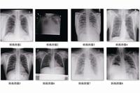 Design and Implementation of a Computer-Aided Diagnosis System Based on Deep Learning in Embedded Systems