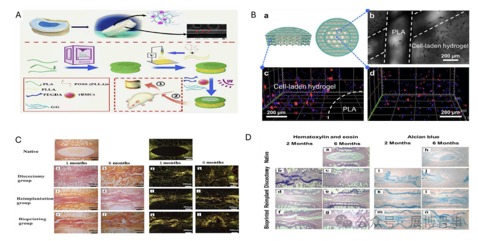 Innovative Solutions for Intervertebral Disc Degeneration: Breakthroughs in 3D Bioprinting by a South Korean Team