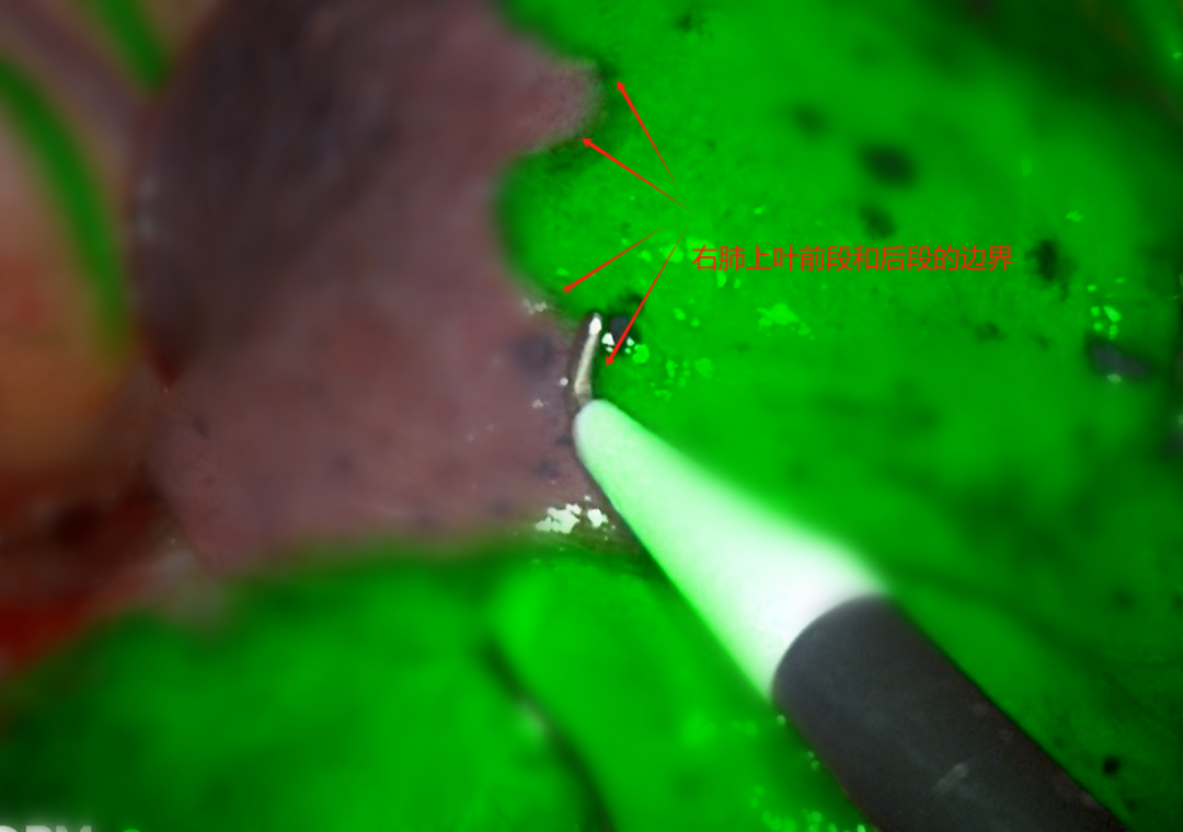 Quality Medical Care: Robots 'Surgical Knives' Ensure Precision!