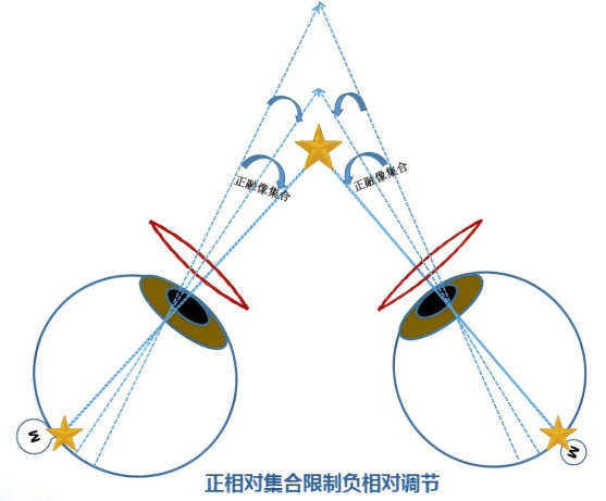 The Relationship Between Accommodation and Convergence: CA/C and AC/A and Their Examination Methods