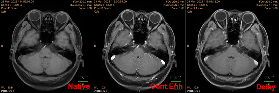Case Study: Is ADC Reliable?