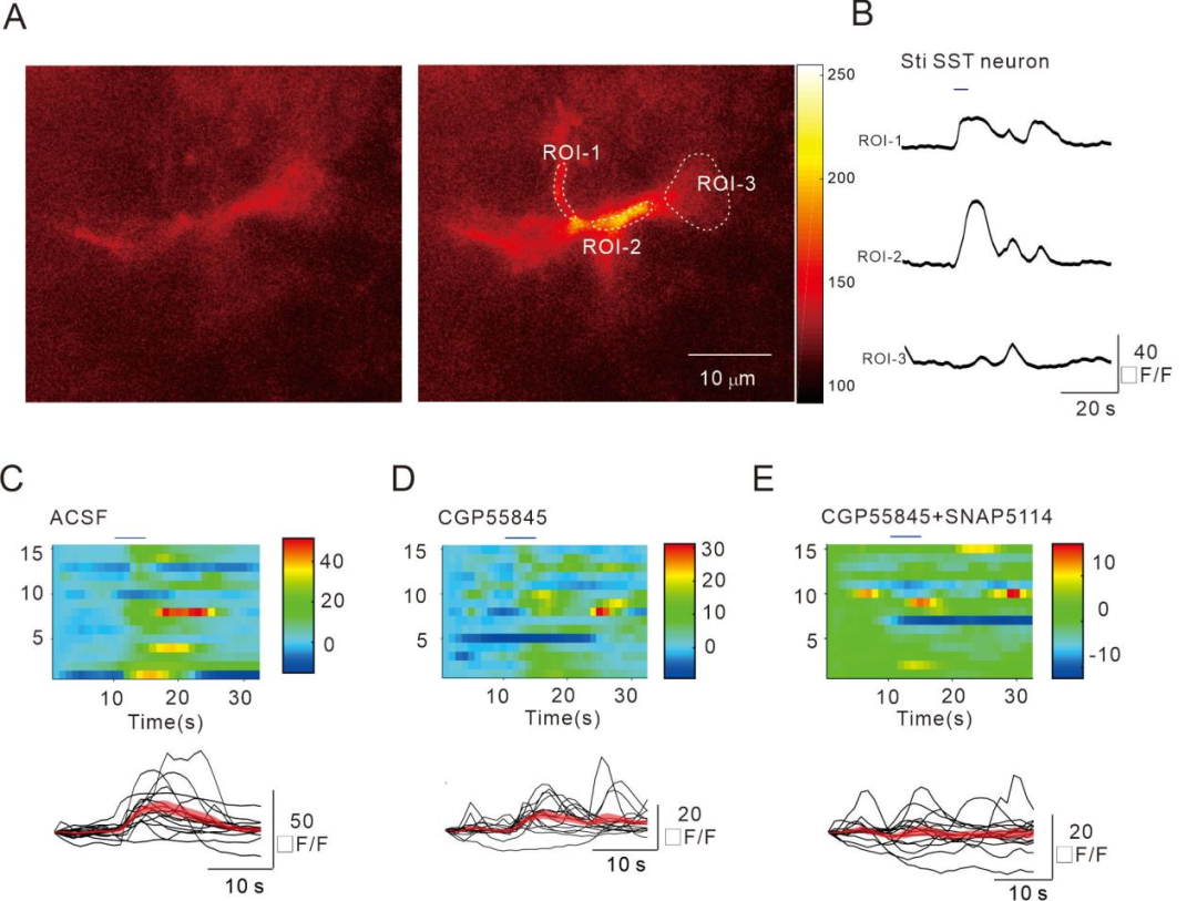 Zeng Linghui's Research Group at the Medical School Reveals the Mechanism by which Somatostatin Interneurons (SOM-INs) Regulate Excitatory Synapses through Astrocytic Purinergic Signaling