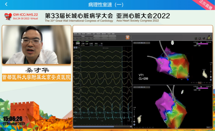 GW-ICC Report | Ventricular Arrhythmia Forum: Overcoming Challenges in Electrophysiological Technology