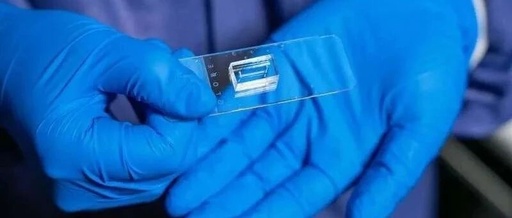 Customized Vascular Chips Simulating Real Vascular Structures to Aid Vascular Disease Research