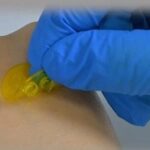 Introduction to EFL Products: Projection-Based Photocurable Bio 3D Printing Applications - Suction Cup Patch