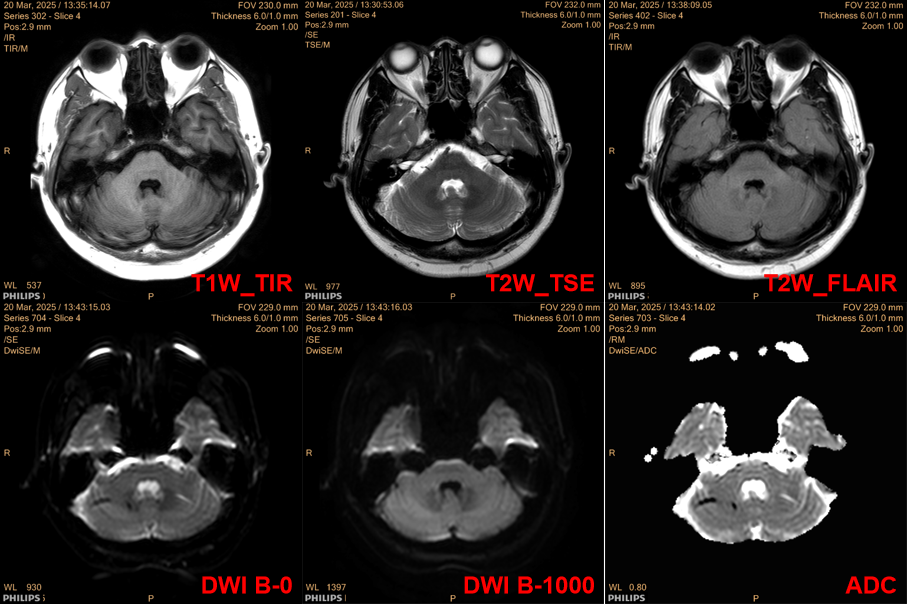 Case Study: Is ADC Reliable?