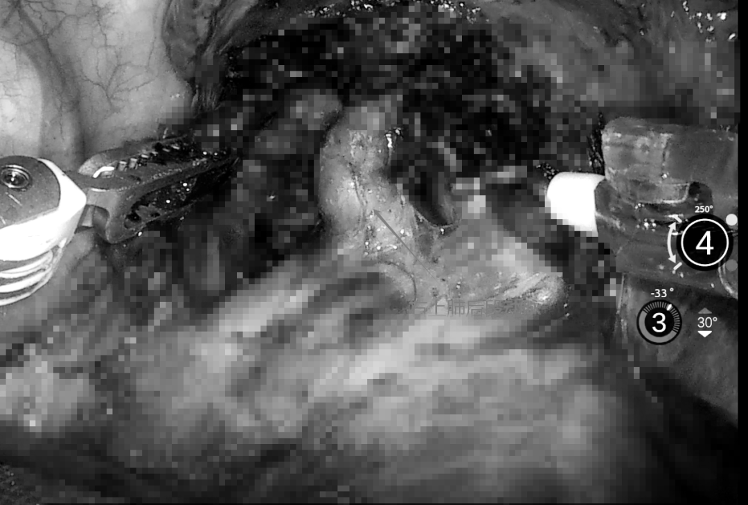 Quality Medical Care: Robots 'Surgical Knives' Ensure Precision!