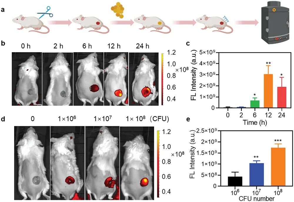 Bacterial Microenvironment-Responsive Microneedle Patches for Real-Time Monitoring and Synergistic Eradication of Infection