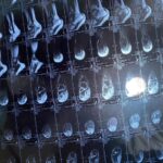 Control Issues in Embedded Systems