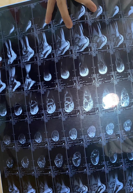 Control Issues in Embedded Systems