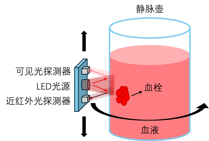 Professor Zhang Ling: Advances and Breakthroughs in Severe Blood Purification Technology