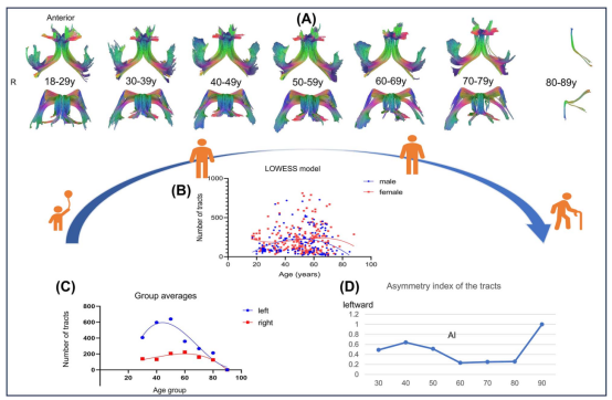 Cerebral Cortex: Professor Xu Haibo's Team at Wuhan University Applies 5.0 T Ultra-High-Resolution Diffusion Imaging to Reveal Lifelong Development Trajectories of the Human Fornix