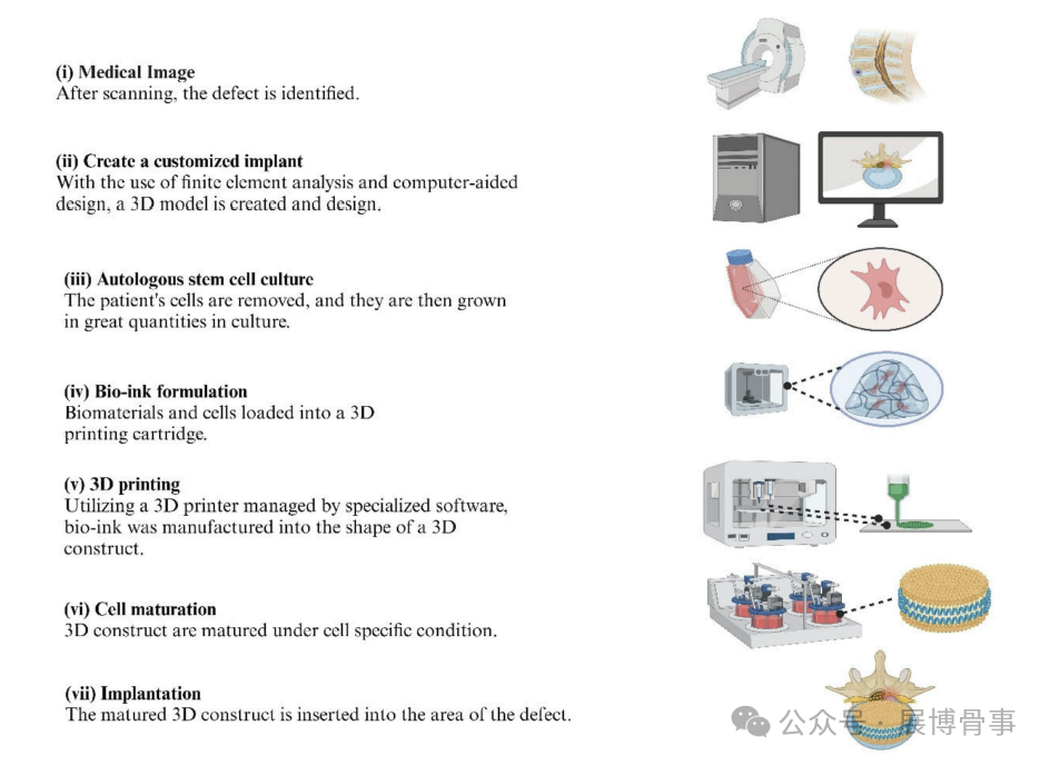 Innovative Solutions for Intervertebral Disc Degeneration: Breakthroughs in 3D Bioprinting by a South Korean Team