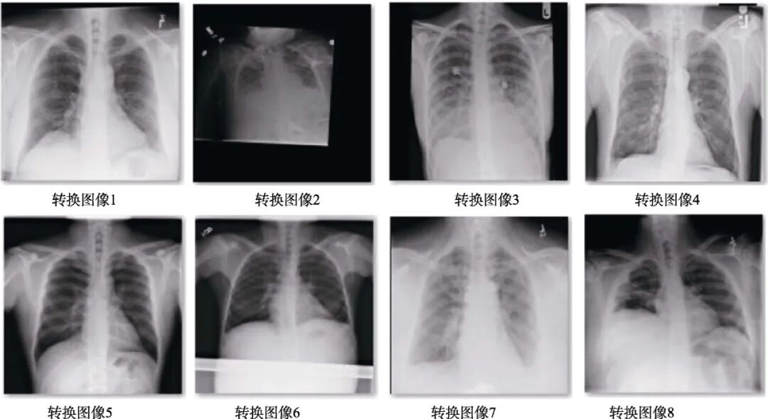 Design and Implementation of a Computer-Aided Diagnosis System Based on Deep Learning in Embedded Systems