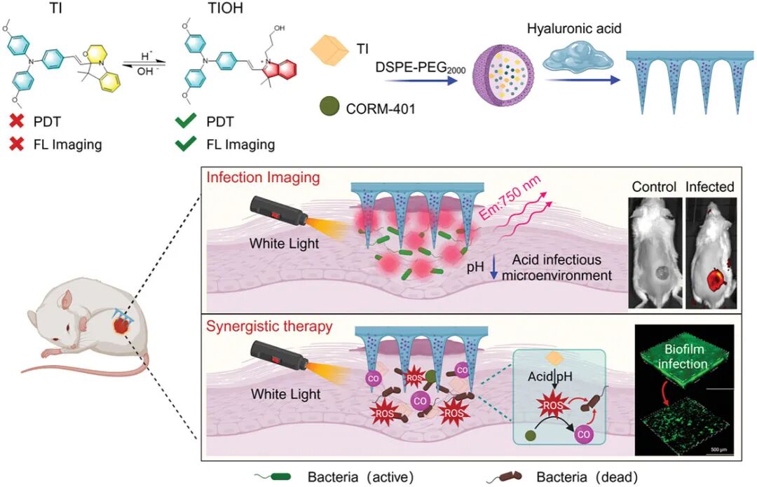 Bacterial Microenvironment-Responsive Microneedle Patches for Real-Time Monitoring and Synergistic Eradication of Infection